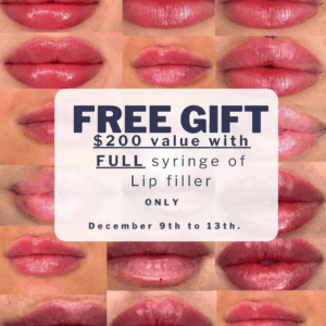 <img src="4.png" alt="Free gift full syringe of Lip Filler only 12/09/25 to 12/13/2025">