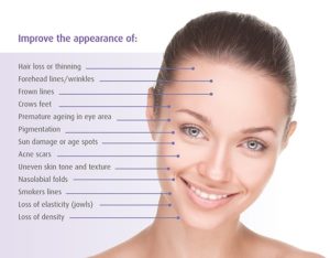 Fractional Mesotherapy Benefits - Revive Medical Botox and Laser